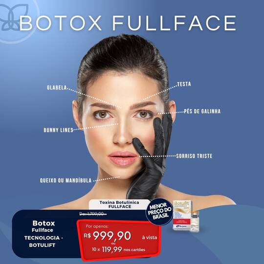botox fullface huff life